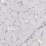Calreticulin Antibody in Immunohistochemistry (Paraffin) (IHC (P))