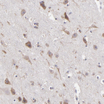 Calreticulin Antibody in Immunohistochemistry (Paraffin) (IHC (P))