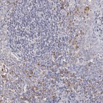 Calreticulin Antibody in Immunohistochemistry (Paraffin) (IHC (P))