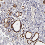Calreticulin Antibody in Immunohistochemistry (Paraffin) (IHC (P))