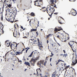 Calreticulin Antibody in Immunohistochemistry (Paraffin) (IHC (P))