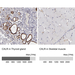 Calreticulin Antibody in Immunohistochemistry (Paraffin) (IHC (P))