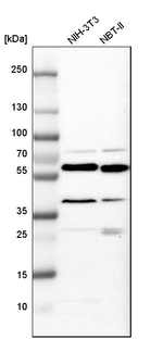 Calreticulin Antibody in Western Blot (WB)