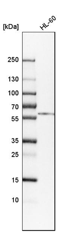 Calreticulin Antibody in Western Blot (WB)