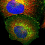 beta-2 Microglobulin Polyclonal Antibody