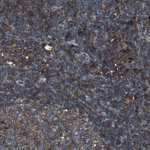 beta-2 Microglobulin Antibody in Immunohistochemistry (Paraffin) (IHC (P))