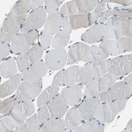 beta-2 Microglobulin Antibody in Immunohistochemistry (Paraffin) (IHC (P))