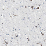 beta-2 Microglobulin Antibody in Immunohistochemistry (Paraffin) (IHC (P))