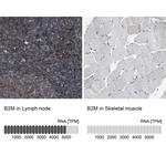 beta-2 Microglobulin Antibody in Immunohistochemistry (Paraffin) (IHC (P))