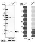 beta-2 Microglobulin Antibody in Western Blot (WB)