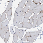 GRP78 Antibody in Immunohistochemistry (Paraffin) (IHC (P))