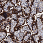 GRP78 Antibody in Immunohistochemistry (Paraffin) (IHC (P))