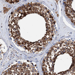 GRP78 Antibody in Immunohistochemistry (Paraffin) (IHC (P))