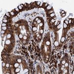 GRP78 Antibody in Immunohistochemistry (Paraffin) (IHC (P))