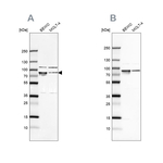 GRP78 Antibody in Western Blot (WB)