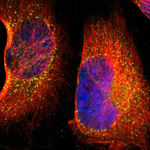 BTK Polyclonal Antibody