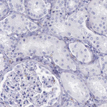 BTK Antibody in Immunohistochemistry (Paraffin) (IHC (P))