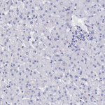 BTK Antibody in Immunohistochemistry (Paraffin) (IHC (P))