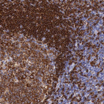 BTK Antibody in Immunohistochemistry (Paraffin) (IHC (P))