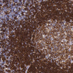 BTK Antibody in Immunohistochemistry (Paraffin) (IHC (P))