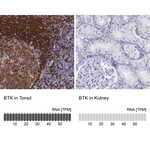BTK Antibody in Immunohistochemistry (Paraffin) (IHC (P))