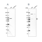 BTK Antibody in Western Blot (WB)