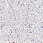 BTK Antibody in Immunohistochemistry (Paraffin) (IHC (P))