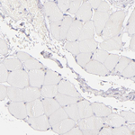 BTK Antibody in Immunohistochemistry (Paraffin) (IHC (P))