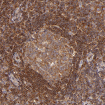 BTK Antibody in Immunohistochemistry (Paraffin) (IHC (P))