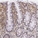 BTK Antibody in Immunohistochemistry (Paraffin) (IHC (P))