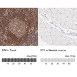 BTK Polyclonal Antibody