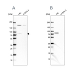 BTK Antibody in Western Blot (WB)