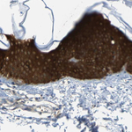 14-3-3 sigma Antibody in Immunohistochemistry (Paraffin) (IHC (P))