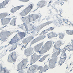 14-3-3 sigma Antibody in Immunohistochemistry (Paraffin) (IHC (P))