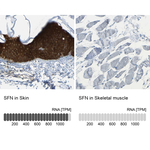 14-3-3 sigma Antibody in Immunohistochemistry (Paraffin) (IHC (P))