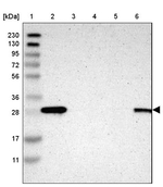 14-3-3 sigma Antibody in Western Blot (WB)