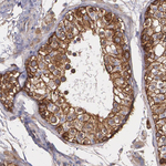 ZO-1 Antibody in Immunohistochemistry (Paraffin) (IHC (P))