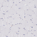 ZO-1 Antibody in Immunohistochemistry (Paraffin) (IHC (P))