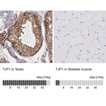 ZO-1 Antibody in Immunohistochemistry (Paraffin) (IHC (P))