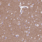 Synapsin 1 Antibody in Immunohistochemistry (Paraffin) (IHC (P))