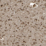 Calnexin Antibody in Immunohistochemistry (Paraffin) (IHC (P))