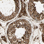 Calnexin Antibody in Immunohistochemistry (Paraffin) (IHC (P))