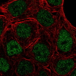 PPAR gamma Polyclonal Antibody