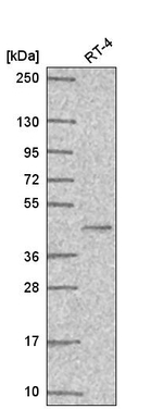 PPAR gamma Antibody in Western Blot (WB)