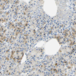 PAK1 Antibody in Immunohistochemistry (Paraffin) (IHC (P))