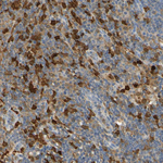 PAK1 Antibody in Immunohistochemistry (Paraffin) (IHC (P))