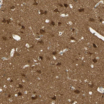 PAK1 Antibody in Immunohistochemistry (Paraffin) (IHC (P))