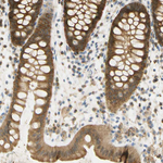 PAK1 Antibody in Immunohistochemistry (Paraffin) (IHC (P))