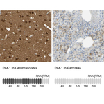 PAK1 Antibody in Immunohistochemistry (Paraffin) (IHC (P))