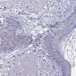 N-cadherin Antibody in Immunohistochemistry (Paraffin) (IHC (P))